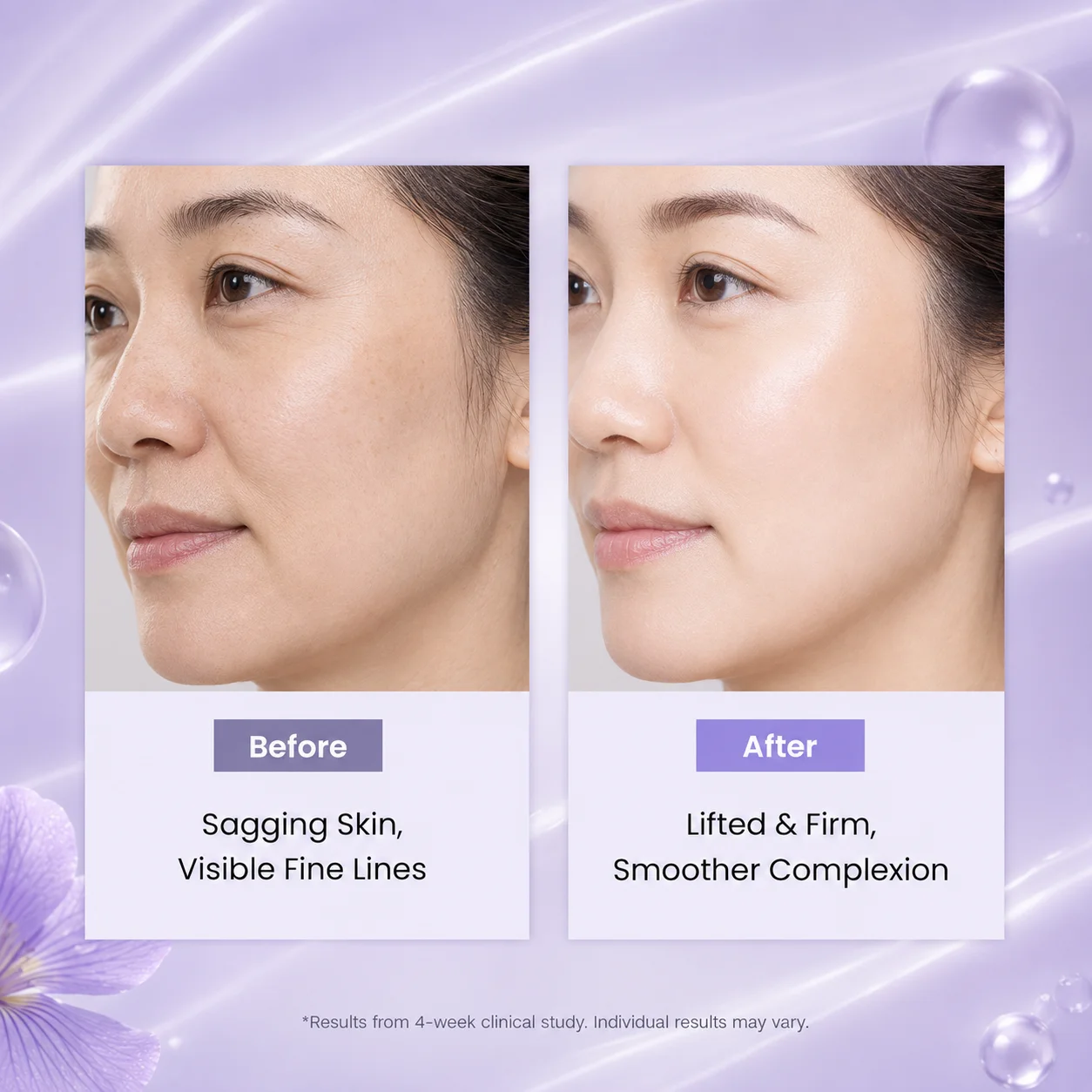 Side-by-side comparison of a woman's face showing before and after skincare results, highlighting smoother and firmer skin.